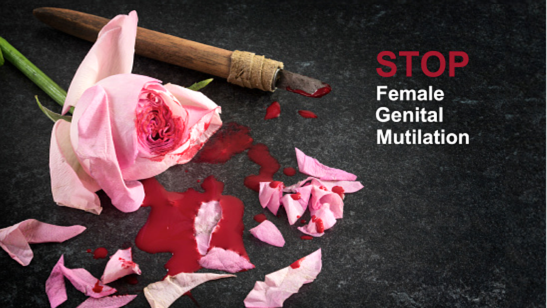 Stop FGM